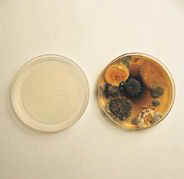 mold and bacteria